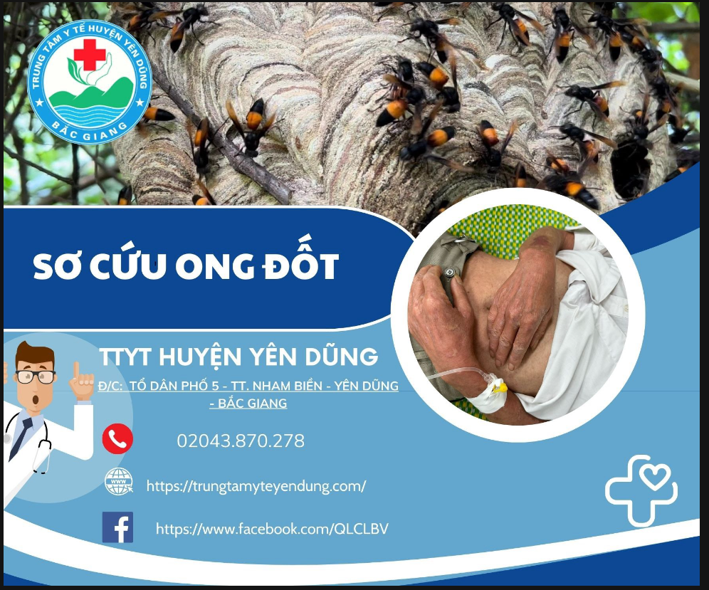 Hướng dẫn sơ cứu ong đốt